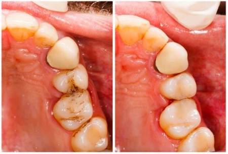 Stomatologia zachowawcza